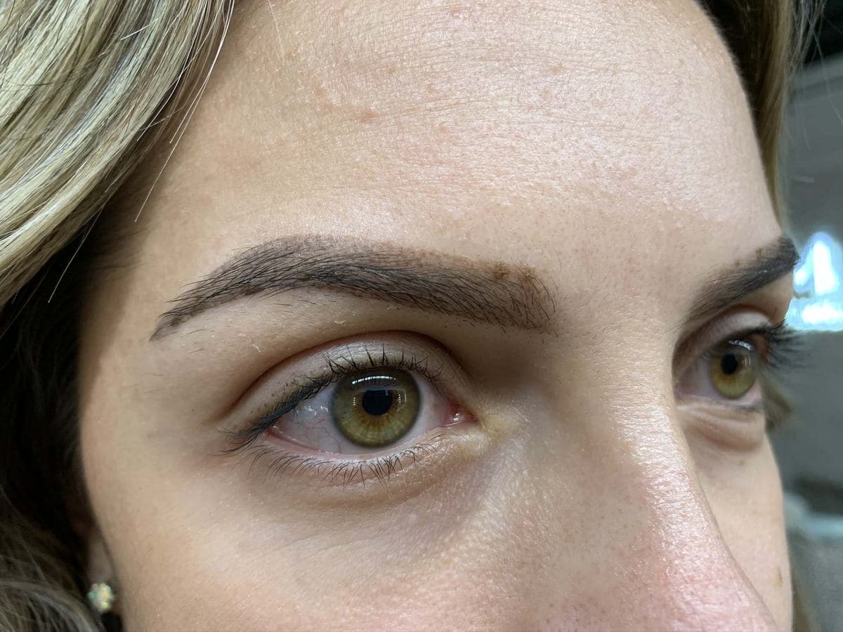 Brow healing - Day 12