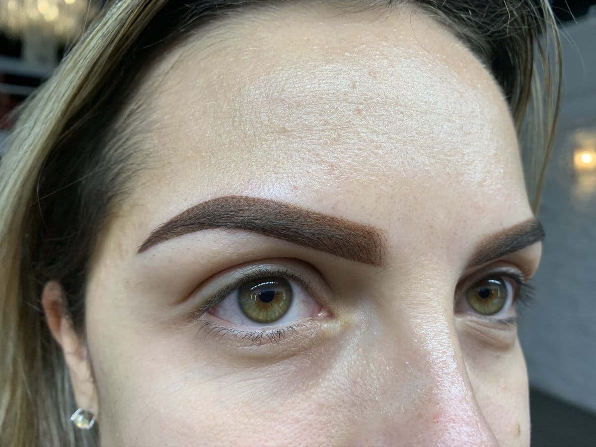 Brow healing - Day 3