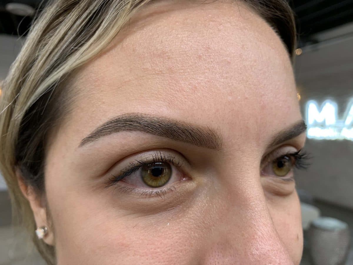 Brow healing - Day 40