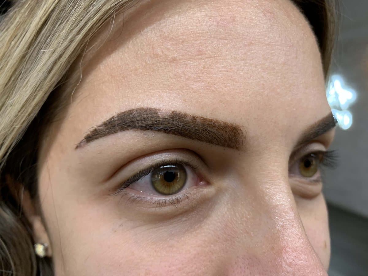 Brow healing - Day 7