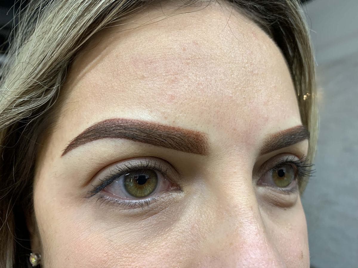 Brow healing - Right After