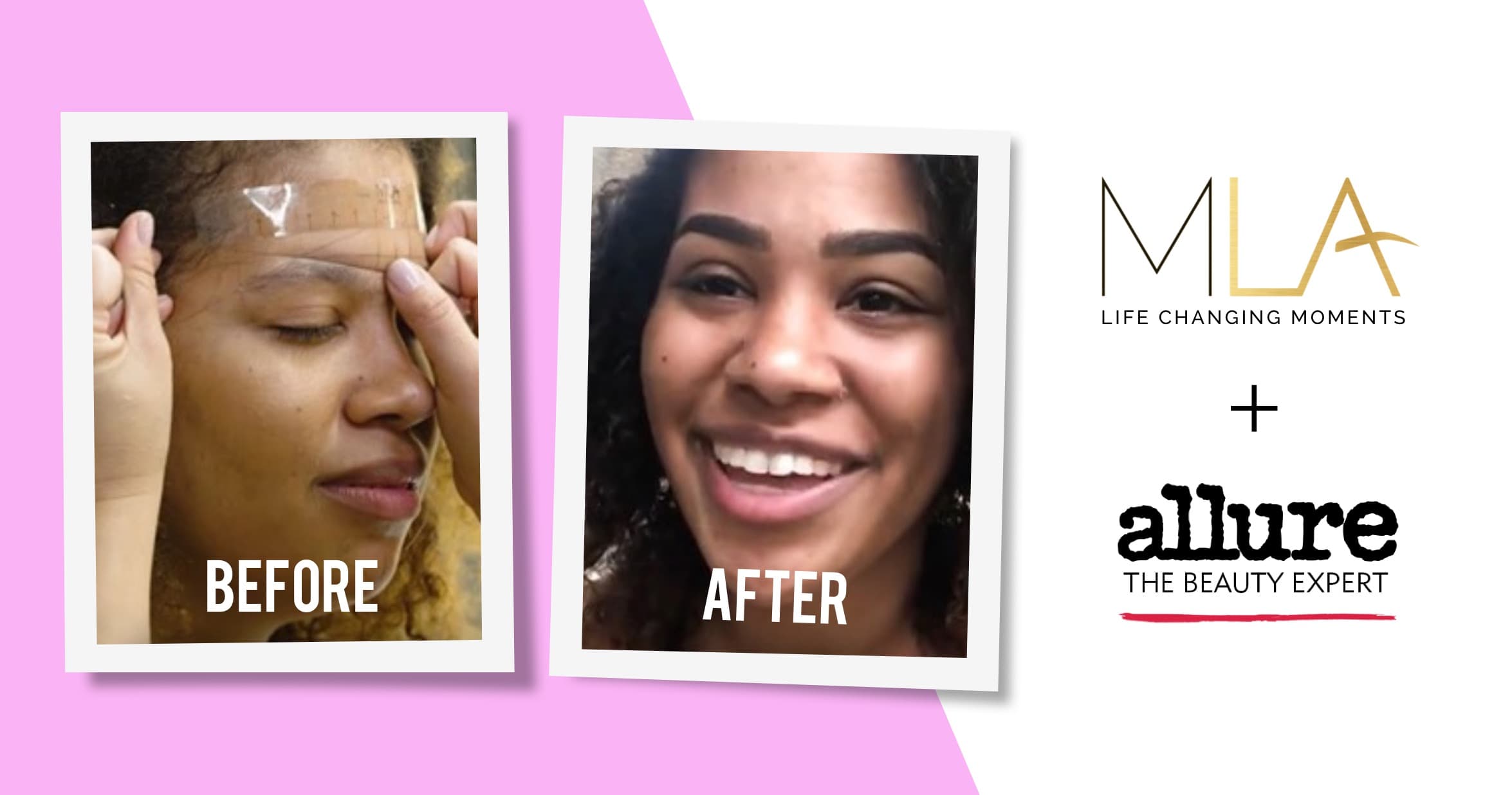 Allure × MLA: Microblading My Brows For The First Time