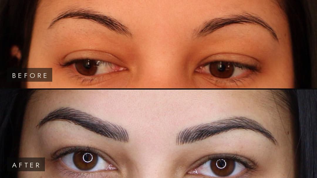 Five Frequently Asked Questions About Microblading
