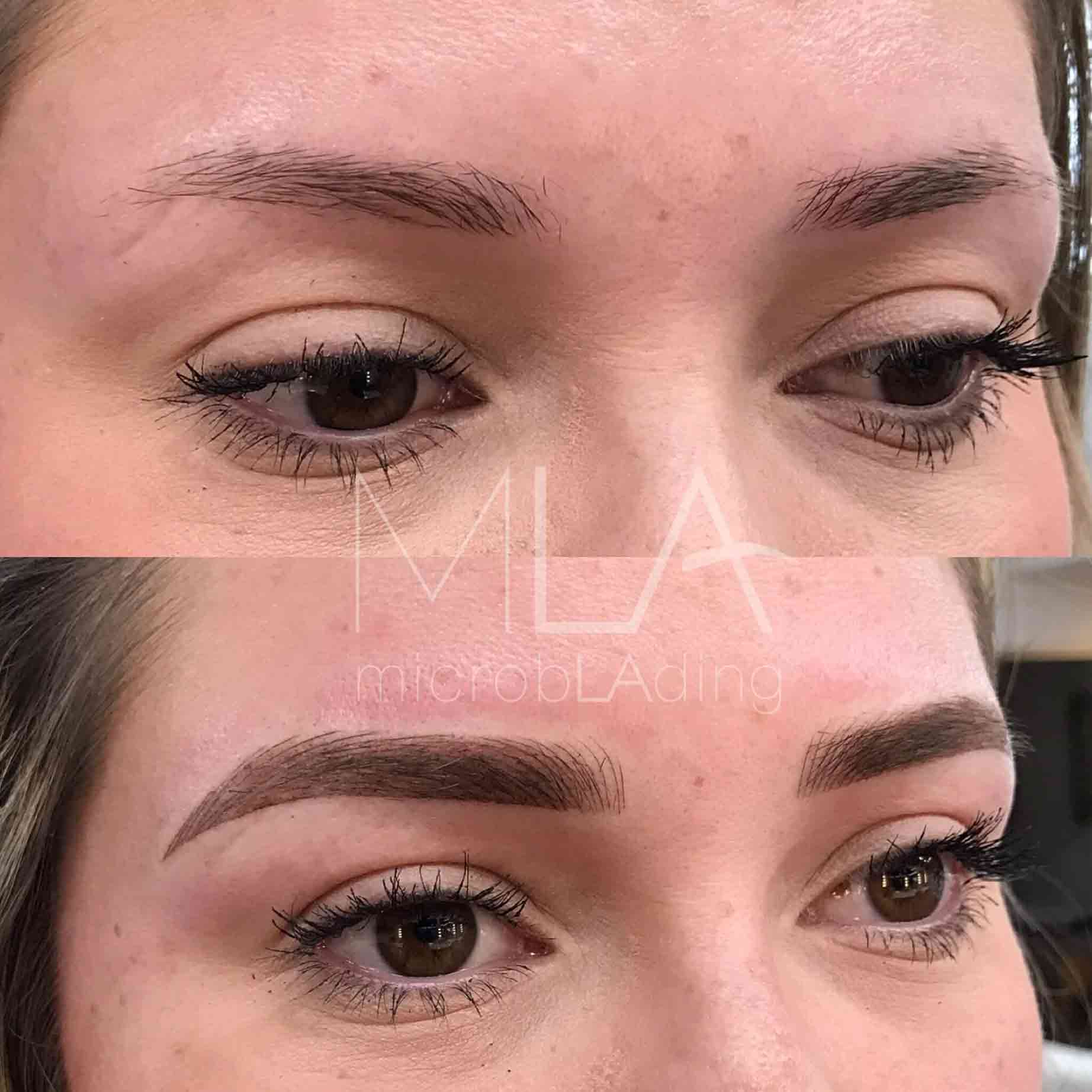 Close-up of microblading procedure showing technique on different skin types