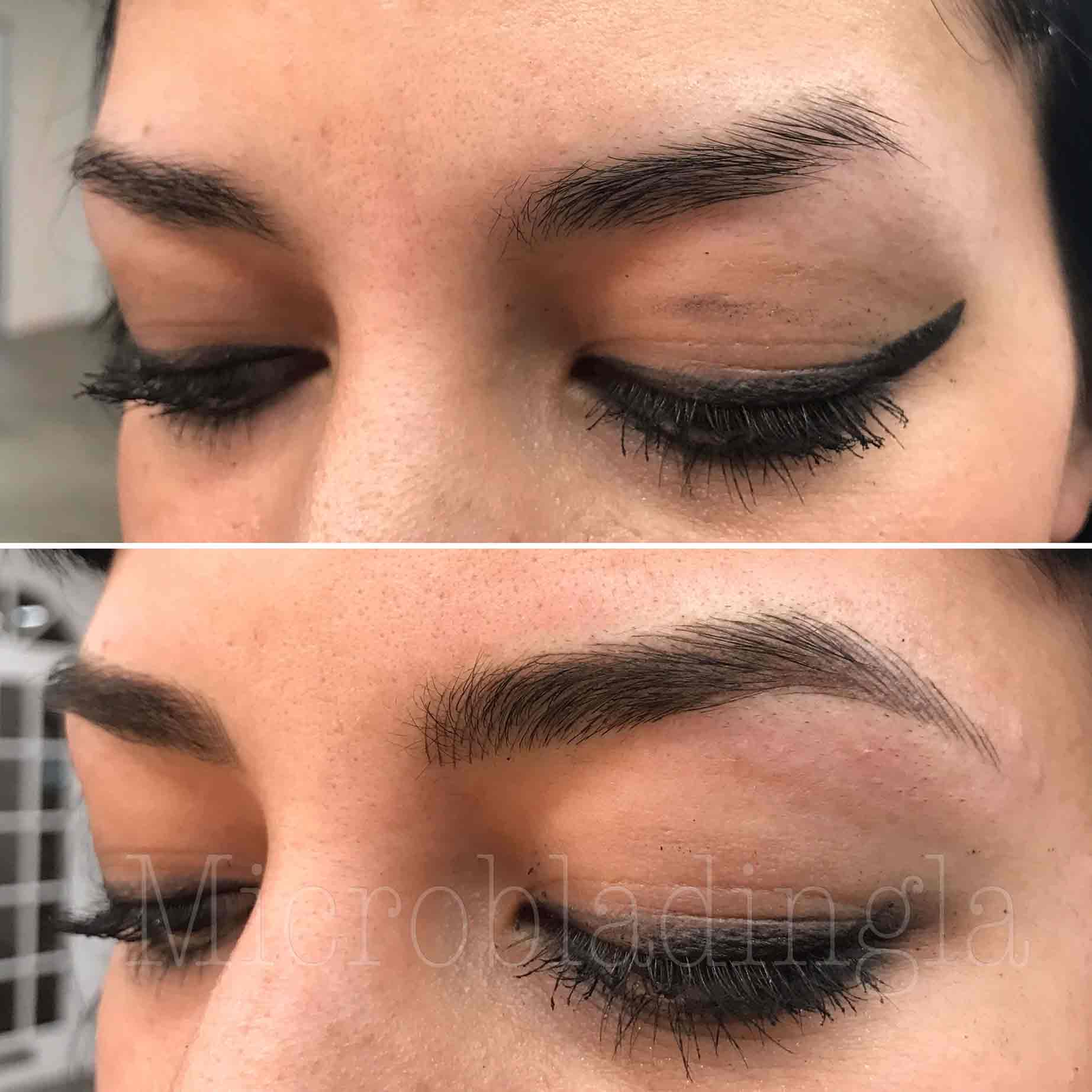 Close-up of microblading technique with considerations for oily skin types