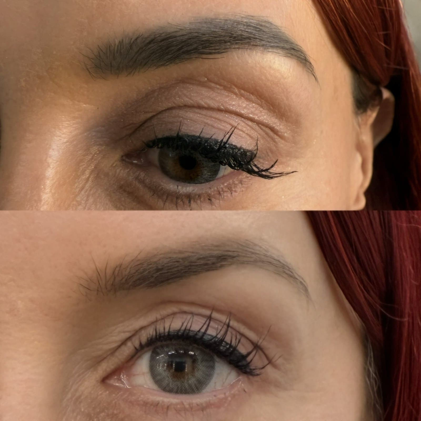 Laser tattoo removal before and after — heavy dark brow tattoo and eyeliner on top, faded and softened below