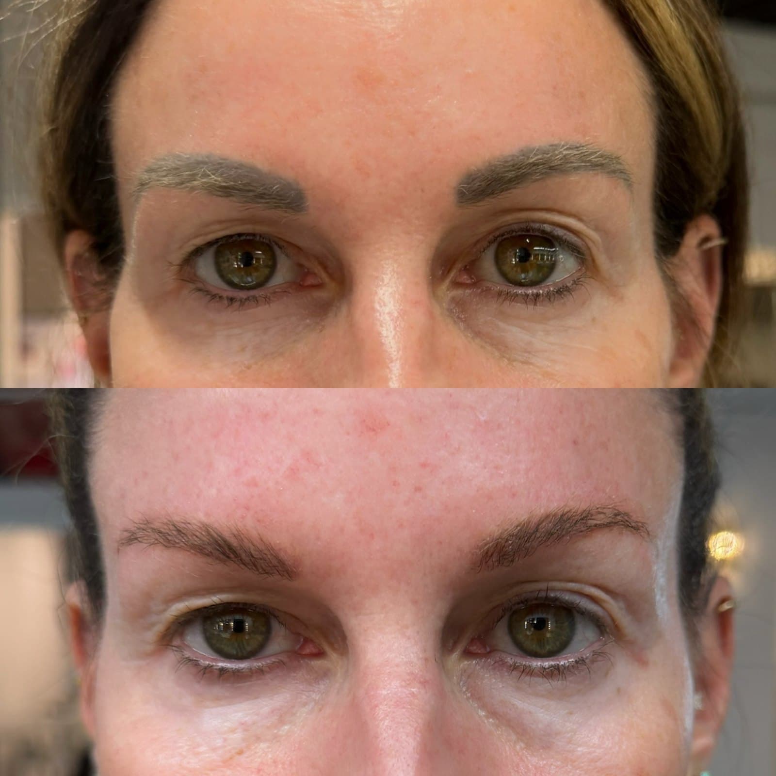 Laser brow tattoo removal before and after — solid gray brow tattoo on top, soft natural brows below