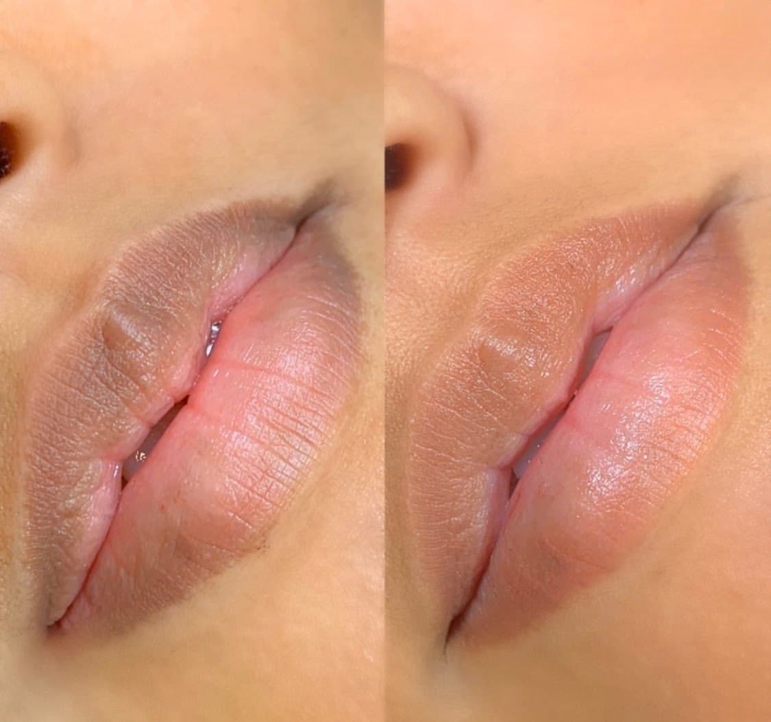 Lip blush before and healed — uneven, darker natural lip tone on the left, even healed color on the right