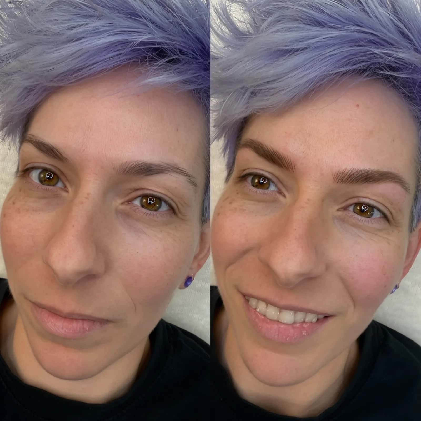Nano Brows before and after at Microblading LA: sparse brows filled into fuller, softly arched medium brown hair-stroke brows