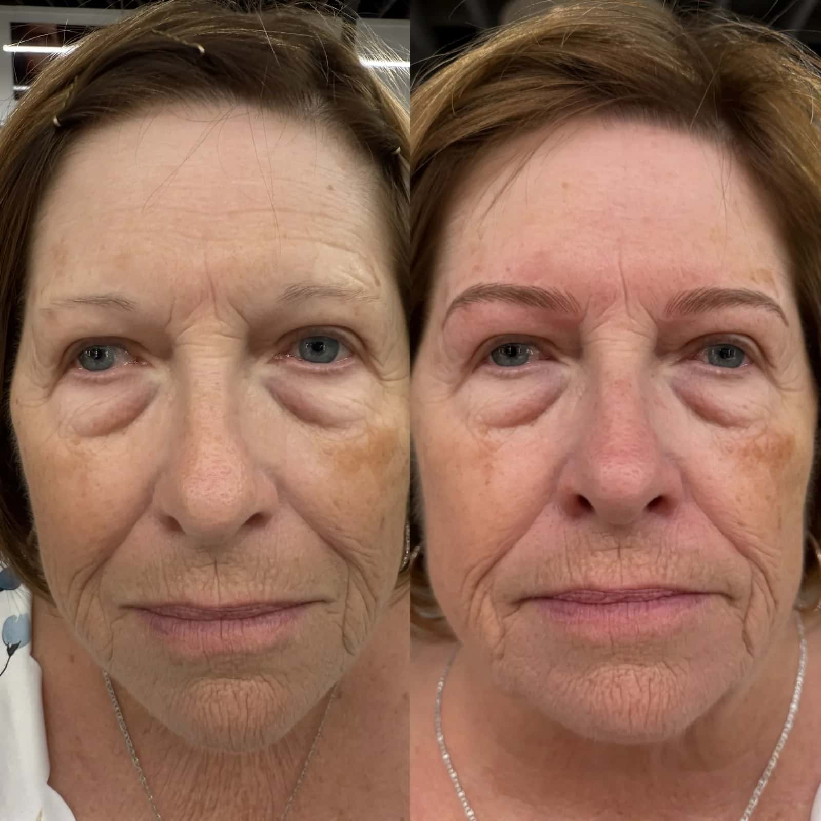 Nano Brows before and after at Microblading LA: sparse, faint brows become fuller, softly arched brows in a natural warm brown