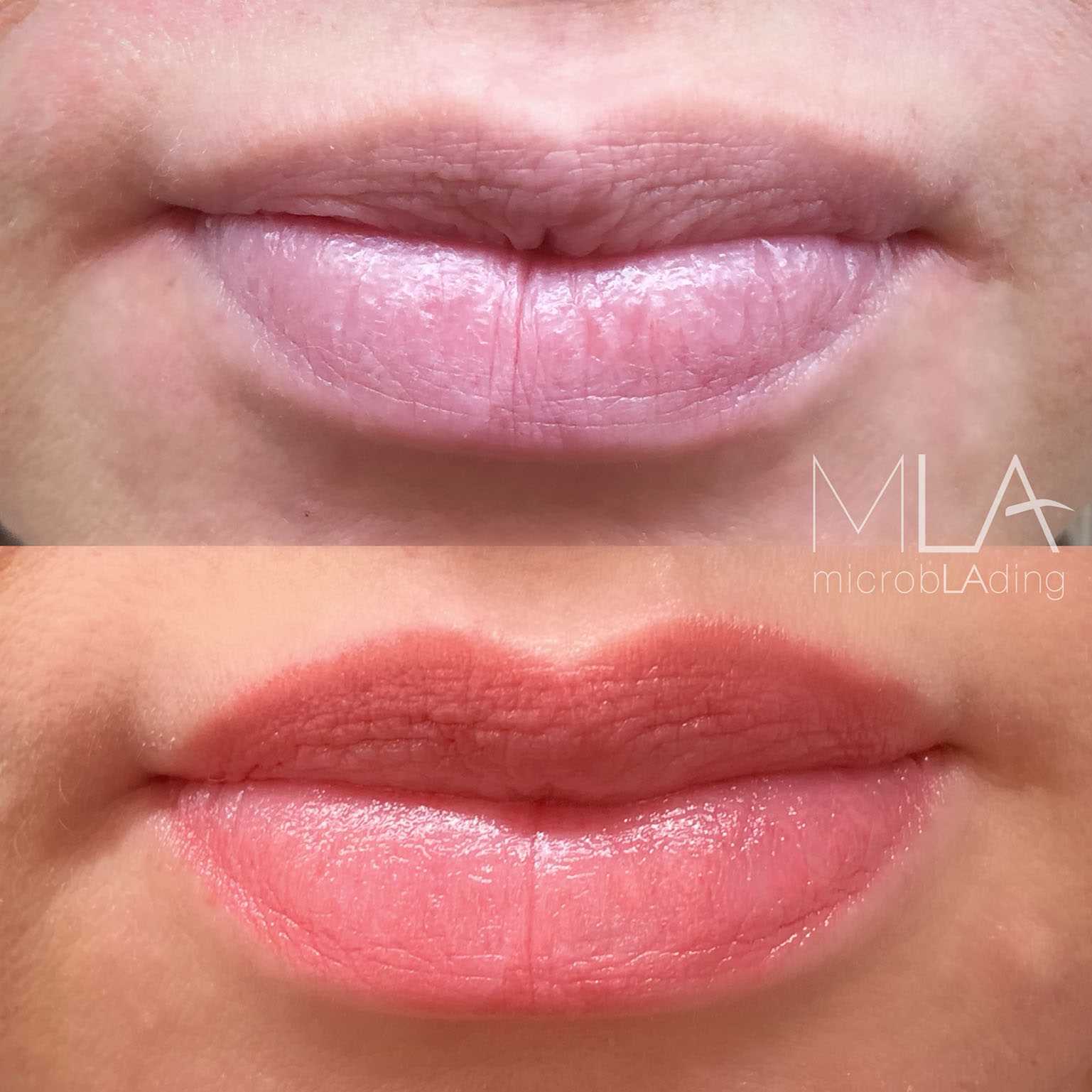 Show All dark lip correction healed lip blush lip blush lip contour lip
