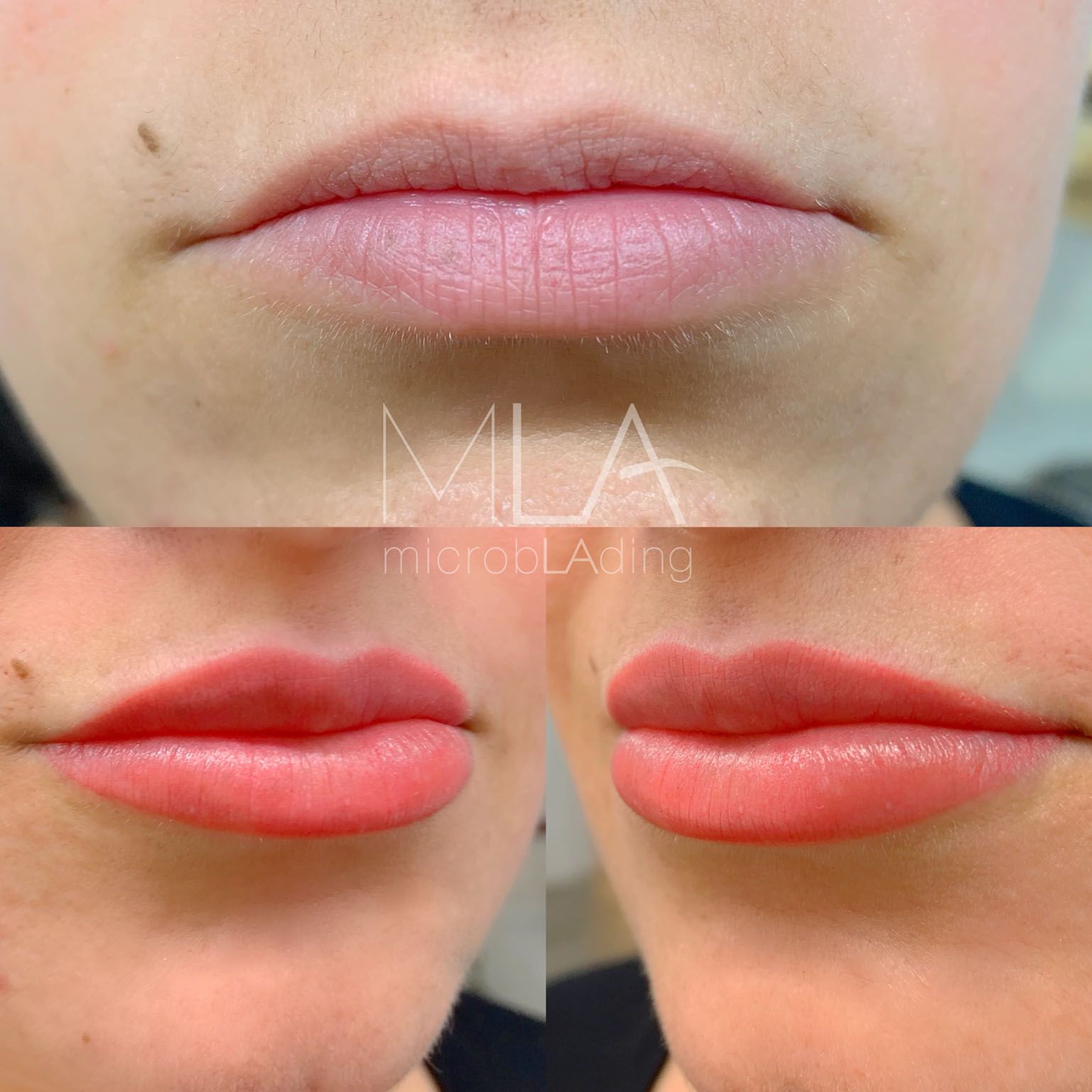 Lip Blush,Lip contour