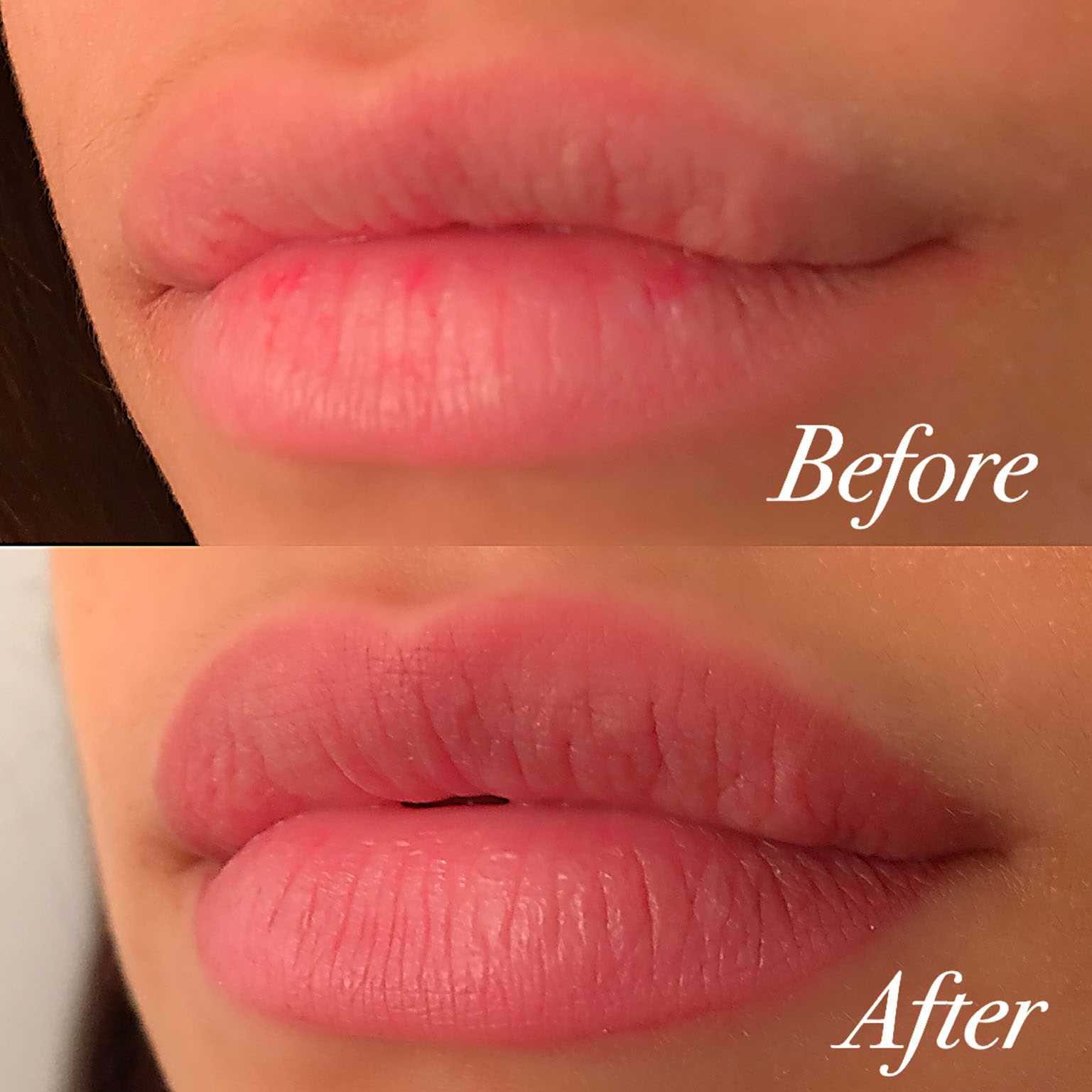 Lip contour,Lip Blush,Healed Lip Blush