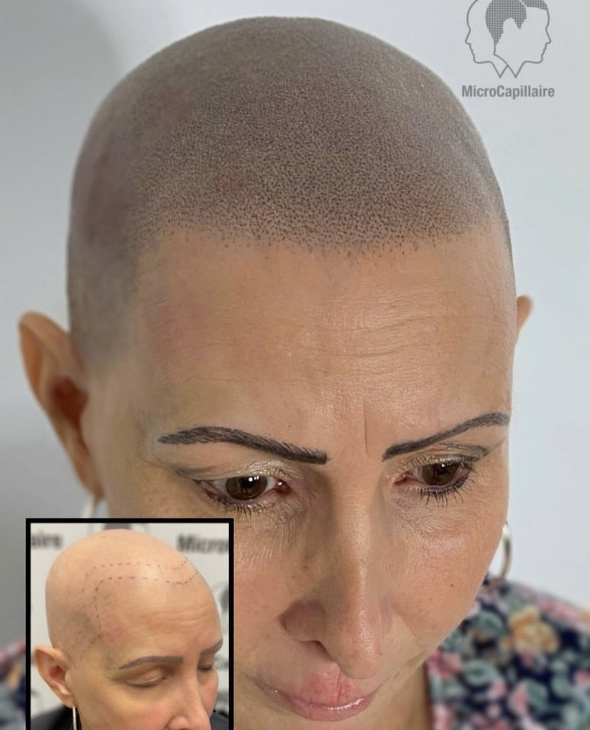 scalp micropigmentation course near me